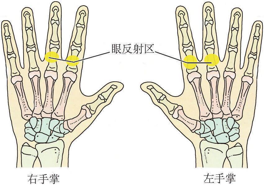 (四)近視
